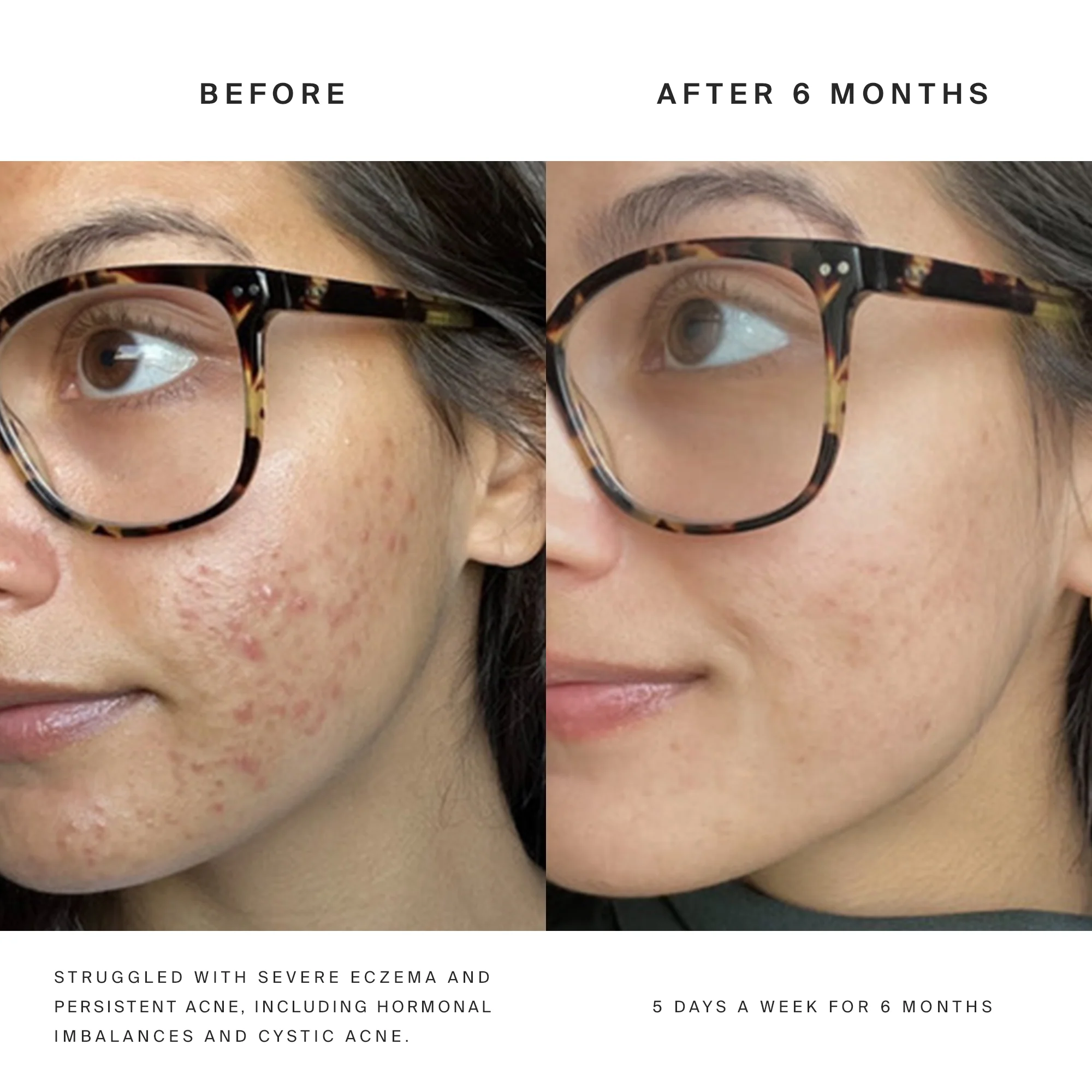 Higherdose Red Light Face Mask - Image 15