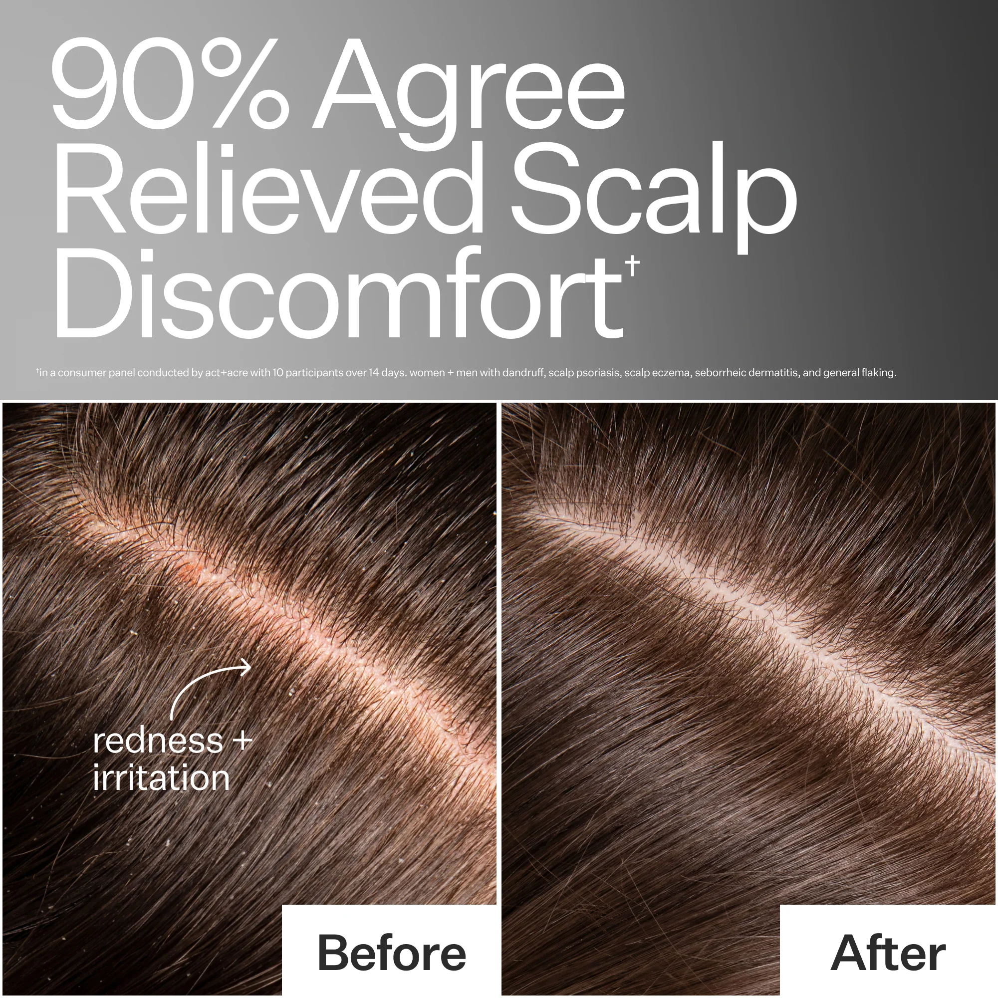 Act + Acre Microbiome Cooling Scalp Serum - Image 3