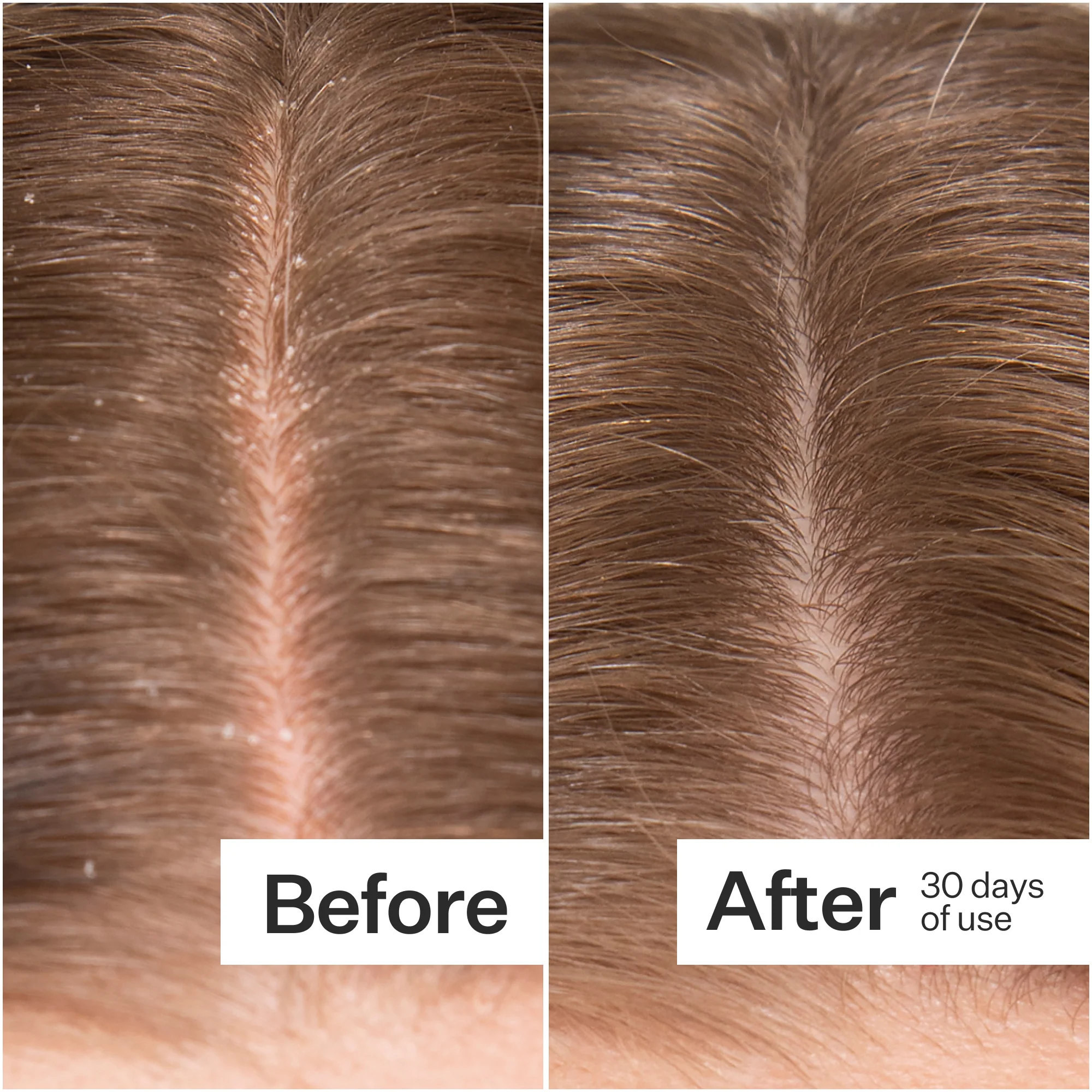 Act + Acre Microbiome Cooling Scalp Serum - Image 4