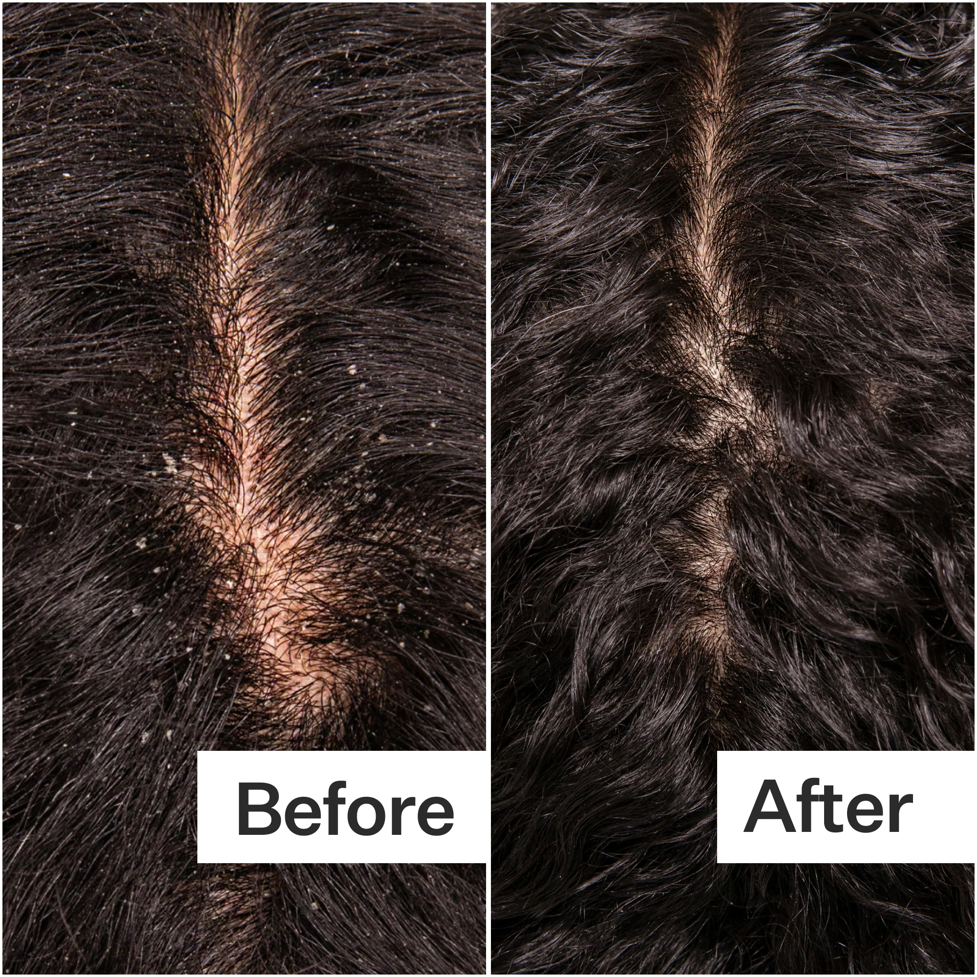 Act + Acre Microbiome Cooling Scalp Serum - Image 5