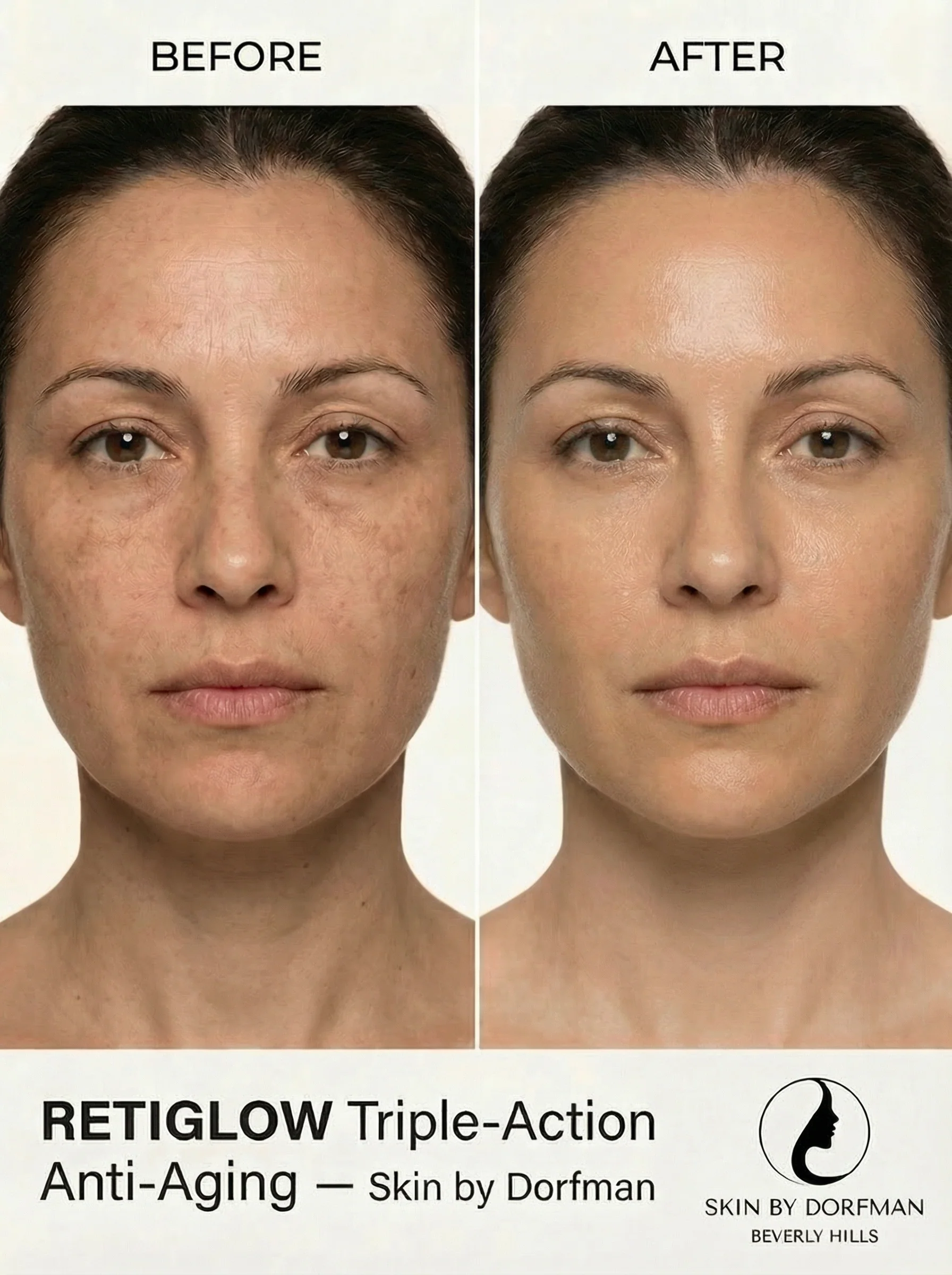 Retiglow - Image 7